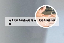 身上出现白斑是啥原因 身上出现白斑是咋回事