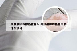 皮肤病验血都检查什么 皮肤病应该检查血液什么项目