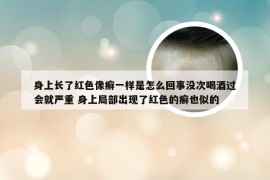 身上长了红色像癣一样是怎么回事没次喝酒过会就严重 身上局部出现了红色的癣也似的