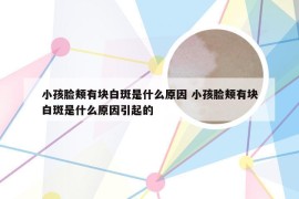 小孩脸颊有块白斑是什么原因 小孩脸颊有块白斑是什么原因引起的