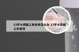 13岁小孩腿上有白块怎么办 13岁小孩腿上长条纹