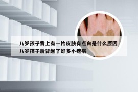 八岁孩子背上有一片皮肤有点白是什么原因 八岁孩子后背起了好多小疙瘩