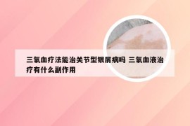 三氧血疗法能治关节型银屑病吗 三氧血液治疗有什么副作用