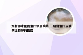 烟台哪家医院治疗银屑病第一 烟台治疗皮肤病比较好的医院