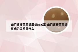 幽门螺杆菌跟银屑病的关系 幽门螺杆菌跟银屑病的关系是什么