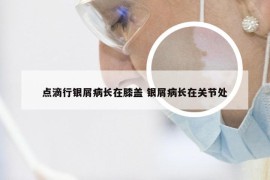 点滴行银屑病长在膝盖 银屑病长在关节处