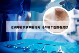 沧州那看皮肤病看得好 沧州哪个医院看皮肤