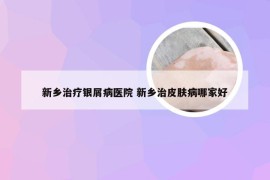 新乡治疗银屑病医院 新乡治皮肤病哪家好