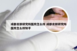 成都皮肤研究所医院怎么样 成都皮肤研究所医院怎么样知乎