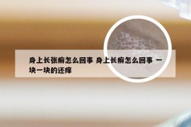 身上长张癣怎么回事 身上长癣怎么回事 一块一块的还痒