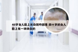 40岁女人脸上长白斑咋回事 四十岁的女人脸上有一块块白的