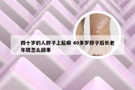 四十岁的人脖子上起癣 40多岁脖子后长老年斑怎么回事