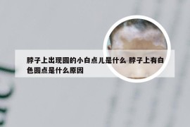 脖子上出现圆的小白点儿是什么 脖子上有白色圆点是什么原因