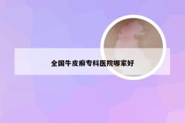 全国牛皮癣专科医院哪家好