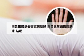 南昌银屑病去哪家医院好 南昌银屑病医院肤康 贴吧