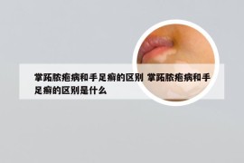 掌跖脓疱病和手足癣的区别 掌跖脓疱病和手足癣的区别是什么