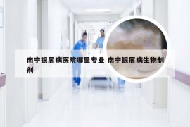 南宁银屑病医院哪里专业 南宁银屑病生物制剂