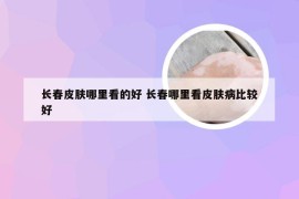 长春皮肤哪里看的好 长春哪里看皮肤病比较好