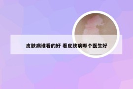 皮肤病谁看的好 看皮肤病哪个医生好