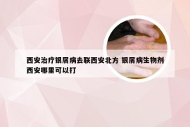 西安治疗银屑病去联西安北方 银屑病生物剂西安哪里可以打