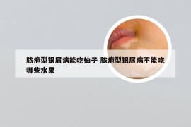 脓疱型银屑病能吃柚子 脓疱型银屑病不能吃哪些水果