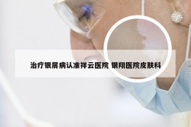 治疗银屑病认准祥云医院 银翔医院皮肤科