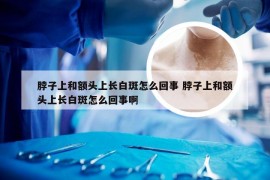 脖子上和额头上长白斑怎么回事 脖子上和额头上长白斑怎么回事啊