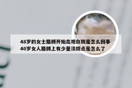 48岁的女士胳膊开始出观白斑是怎么回事 40岁女人胳膊上有少量淡斑点是怎么了