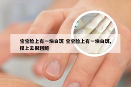 宝宝脸上有一块白斑 宝宝脸上有一块白斑,摸上去很粗糙