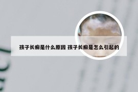 孩子长癣是什么原因 孩子长癣是怎么引起的