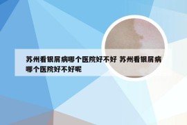 苏州看银屑病哪个医院好不好 苏州看银屑病哪个医院好不好呢