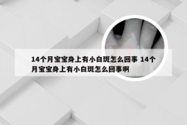 14个月宝宝身上有小白斑怎么回事 14个月宝宝身上有小白斑怎么回事啊