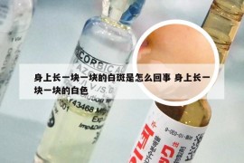 身上长一块一块的白斑是怎么回事 身上长一块一块的白色