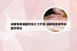 成都银屑病医院有几个疗程 成都银屑病专科医院地址