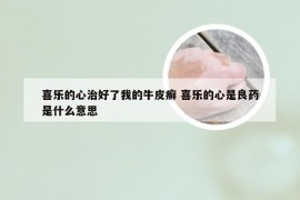 喜乐的心治好了我的牛皮癣 喜乐的心是良药是什么意思