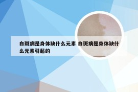 白斑病是身体缺什么元素 白斑病是身体缺什么元素引起的