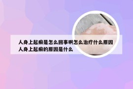 人身上起癣是怎么回事啊怎么治疗什么原因 人身上起癣的原因是什么