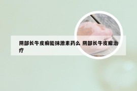 阴部长牛皮癣能抹激素药么 阴部长牛皮廨治疗