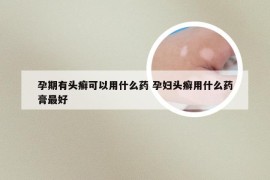 孕期有头癣可以用什么药 孕妇头癣用什么药膏最好