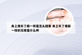 身上像长了癣一样是怎么回事 身上长了像藓一样的又痒是什么啊