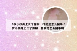 8岁小孩身上长了像癣一样的是怎么回事 8岁小孩身上长了像癣一样的是怎么回事啊