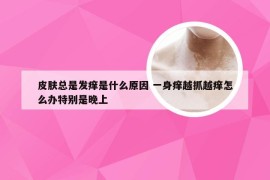 皮肤总是发痒是什么原因 一身痒越抓越痒怎么办特别是晚上