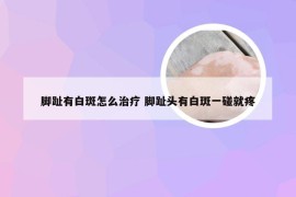 脚趾有白斑怎么治疗 脚趾头有白斑一碰就疼