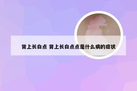 背上长白点 背上长白点点是什么病的症状