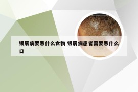 银屑病要忌什么食物 银屑病患者需要忌什么口