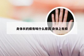 身体长的癣有味什么原因 身体上有癣