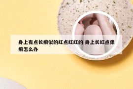 身上有点长癣似的红点红红的 身上长红点像癣怎么办