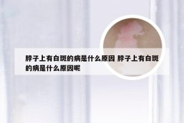 脖子上有白斑的病是什么原因 脖子上有白斑的病是什么原因呢