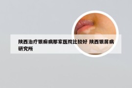 陕西治疗银癣病那家医院比较好 陕西银屑病研究所