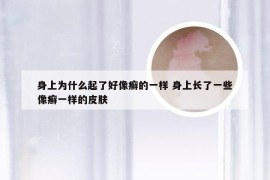 身上为什么起了好像癣的一样 身上长了一些像癣一样的皮肤